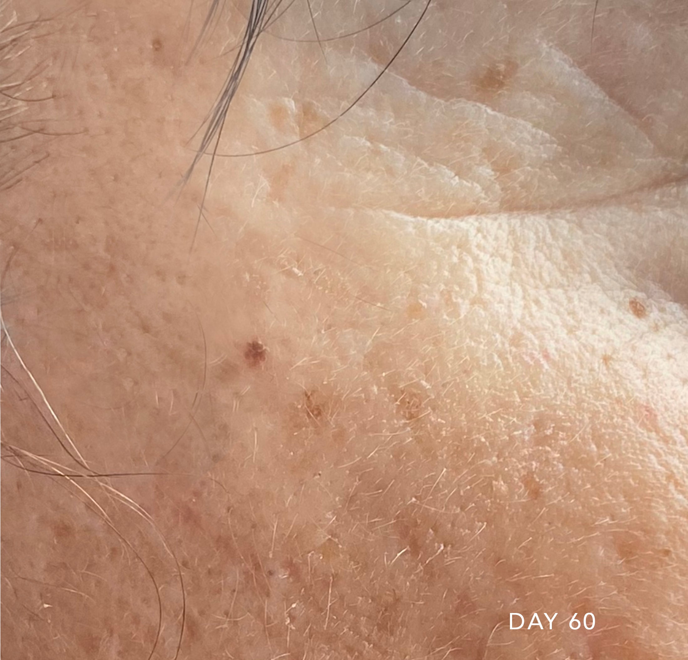 After Day 60