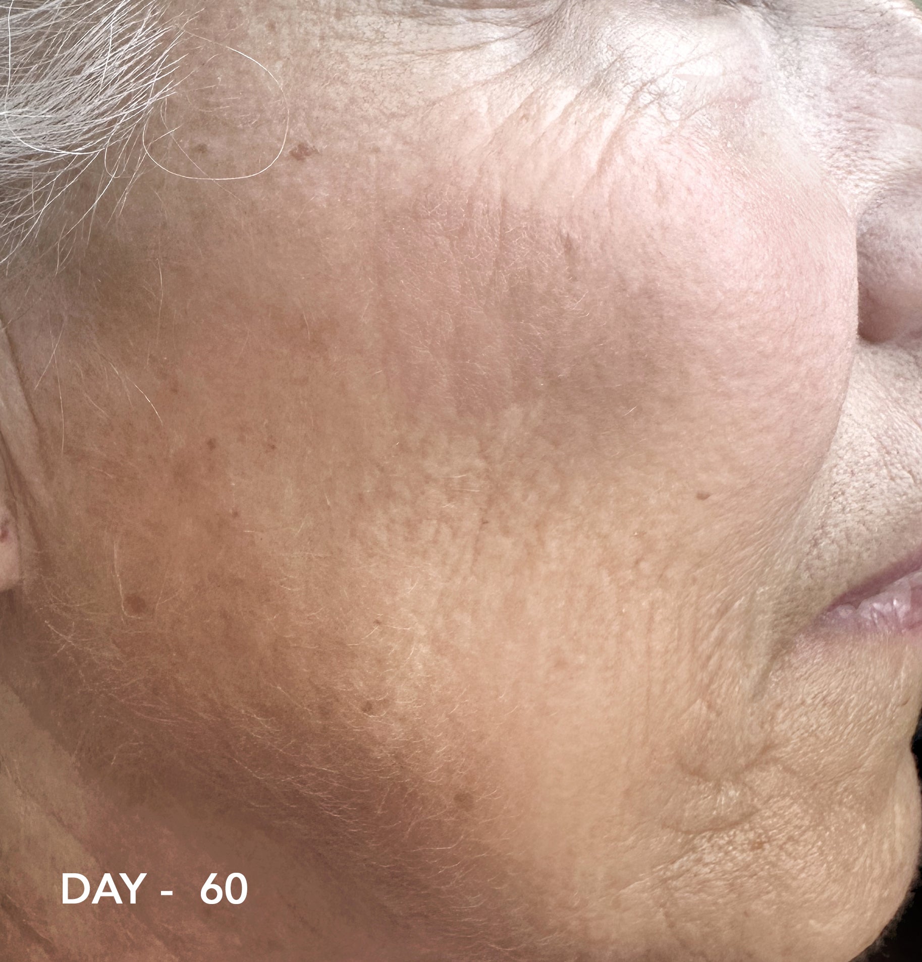 After Day 60